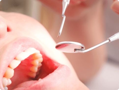 施術前に治療予定歯を確認